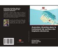 Avancées Récentes Dans Le Traitement De Surface Des Implants Dentaires