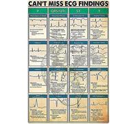 AXHNG Vintage ECG Knowledge Can't Miss ECG Findings Cardiologists Guide Hospital Clinic Office Science Poster Métal Aluminium 20,3 x 15,2 cm Décoration murale
