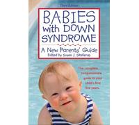 Babies With Down Syndrome: A New Parents' Guide