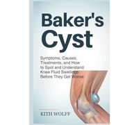 Baker’s Cyst: Symptoms, Causes, Treatments, and How to Spot and Understand Knee Fluid Swellings Before They Get Worse