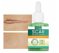 BAOK Gel d'élimination des Cicatrices | Huile pour la réparation des vergetures et l'élimination des Cicatrices,30 ML d'réparation Cicatrice Soin végétal Naturel pour vergetures Cicatrices