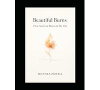 Beautiful Burns: How Survival Rewrote My Life