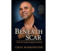 Beneath the Scar: How One Lump Changed Everything