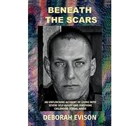 Beneath The Scars: An Unflinching Account Of Living With Severe Self-Injury And Surviving Childhood Sexual Abuse