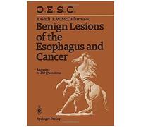 Benign Lesions Of The Esophagus And Cancer