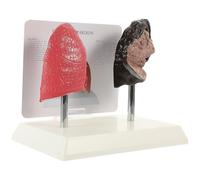 BESPORTBLE Modèle Anatomique Pulmonaire Réaliste en PVC pour Enseignement | Comparaison Médicale, Usage en Physiologie et Anatomie, Destiné aux Étudiants, Modèle Pathologique Éducatif