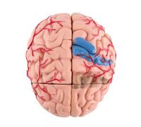 Bewinner Modèle Anatomique de Cerveau Humain démonté pour L'éducation | Conception détachable, sections à code couleur, outil de formation médicale, aide à l\'étude en neurologie, base