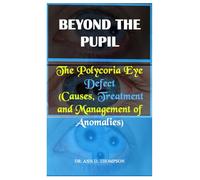 BEYOND THE PUPIL: The Polycoria Eye Defect (Causes, Treatment and Management of Anomalies)
