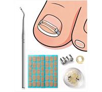 BEZOX Correcteur d'ongles incarnés, application facile à la maison