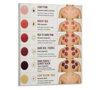 BIANMTSW Cupping Skin Reaction Poster Chart Clinical Use | Helps practitioners distinguish between therapeutic petechiae and adverse skin responses after(Framed,08x12inch(20x30cm))