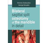 Bilateral Sagittal Split Osteotomy of the Mandible in Detail