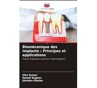 Biomécanique des implants : Principes et applications: Quand l'ingénierie rencontre l'ostéointégration