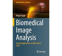 Biomedical Image Analysis: Special Applications in MRIs and CT scans