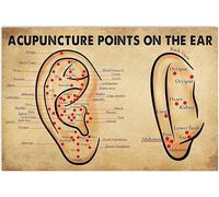 Bioprocess Oreille Anatomie Connaissances Acupuncture Points Sur L'oreille Affiches En Aluminium Médecins Science Populaire Infographie Décoration Murale Décor Cuisine Décoration Murale Affiche