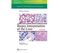 Biopsy Interpretation Of The Liver