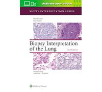 Biopsy Interpretation of the Lung