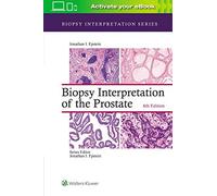 Biopsy Interpretation Of The Prostate