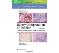 Biopsy Interpretation of the Skin: Primary Non-Lymphoid Cutaneous Neoplasia (Biopsy Interpretation Series) - [Version Originale] Inconnu (Auteur)