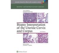Biopsy Interpretation Of The Uterine Cervix And Corpus (Biopsy Interpretation Series) (Hardcover) Anais Malpica, Elizabeth D Euscher (Auteur)