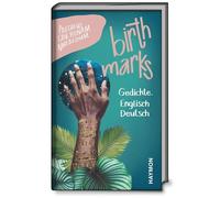 Birthmarks