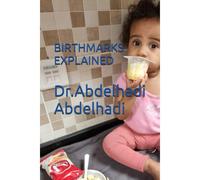Birthmarks Explained: 3 (Hadi Baby Parents Series)