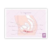 Bivea | Schéma anatomique Vaginisme | Format A5