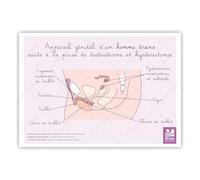Bivea | Schéma appareil génital homme trans après testo et hystérectomie | Format A5