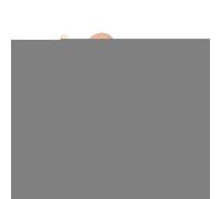 Blocs-cylindres À Boutons - Taille 15,5 X 4,5 X 3,5 Cm, Construction En Bois, Conception De Bouton À Douille En Échelle, Léger 500 G | Jouet Sensoriel Pour L'éducation Précoce, Tri Des Formes