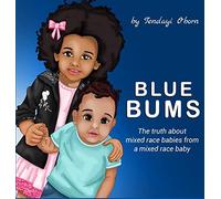 Blue Bums: The Truth About Mixed Race Babies, From A Mixed Race Baby