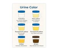 Body Hydration Status Chart Educational Canvas Print for Bathroom Office Wellness Clinic Decor(Framed,12x18inch(30x45cm))