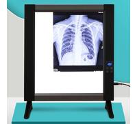 Boîte de panneau LED à rayons X, lecteur de film professionnel, visionneuse de diapositives, panneau acrylique et cadre en aluminium, luminosité réglable de 0 à 100%, sans ombres(Single couplet)