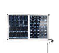 Boîte Lumineuse D'illuminateur de Film à Rayons X Éclairage LED Mural, for Bureau et Hôpital, Luminosité Variable
