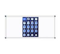 Boîte Lumineuse LED for Visionneuse De Films Radiographiques, Visionneuse De Films LED Portable avec Support, for Clinique, Hôpital, Montage Mural ou Sur Pied(115x47cm/45.3x18.5in)