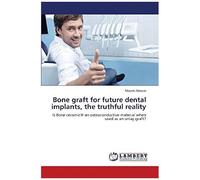 Bone Graft For Future Dental Implants, The Truthful Reality