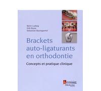 Brackets Auto-Ligaturants En Orthodontie - Concepts Et Pratique Clinique