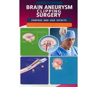 Brain Aneurysm Clipping Surgery Purpose And Side Effects: Brain Aneurysm Clipping Surgery Is Used To Prevent Or Treat A Ruptured Aneurysm, A Life Threatening Emergency. Here's How It Works.