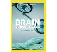 Brain Surgery Live with Mental Floss – National Geographic – DVD – NTSC