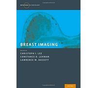 Breast Imaging