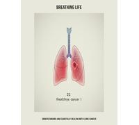 Breathing Life: Understanding And Carefully Dealing With Lung Cancer