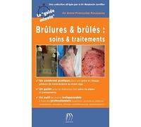 Brûlures & brûlés : soins & traitements