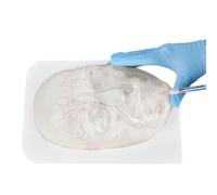 buyzg Modèle Facial injectable, modèle de Visage Transparent avec vaisseaux sanguins pour la Pratique de la microchirurgie Plastique et Les Instructions d'injection cosmétique