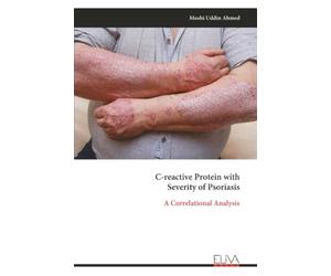 C-reactive Protein with Severity of Psoriasis: A Correlational Analysis