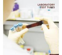 Cabilock 20 pièces Tubes à essai anti-lumière pour échantillons stockage et mélange en laboratoire lot de 20 pièces 15 ml marron tubes pouvant se tenir debout et résistants à la