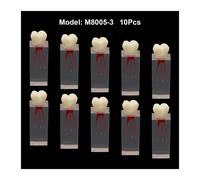 Cabinet Dentaire Endodontique,Canal Radiculaire,Cavit? De Pulpe,Mod?Le De Dents Rct,Bloc D'entra?Nement,?Tude,D?Monstration Du Fonctionnement Des Fichiers - Type 10pcs M8005-3