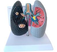 Cadeau médical, modèle de comparaison des poumons for la santé humaine et le tabagisme, modèle broncho-pulmonaire avec carte arrière en anglais, outil d'étude de la santé respiratoire avec