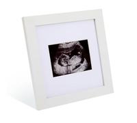 Cadre photo échographique pour bébé - Affichage photo échographique de 8,9 x 6,3 cm, cadre photo à échographie en bois pour annonce de grossesse - Décorations pour futurs parents, fête prénatale, sexe