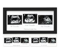 Cadre photo triple sonogramme pour bébé - Cadres photo à ultrasons pour la première fois à future maman - Indispensables pour la grossesse - Annonces de bébé - Décoration de chambre d'enfant, cadeaux