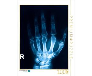 CALVENDO Puzzle radiographique d'un os de Main | Puzzle Photo de 1000 pièces de 48 x 64 cm pour des Heures de Bonheur