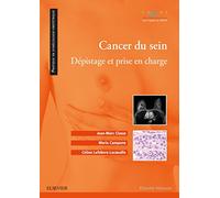Cancer du sein: Dépistage et prise en charge