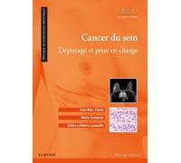 Cancer du sein: Dépistage et prise en charge